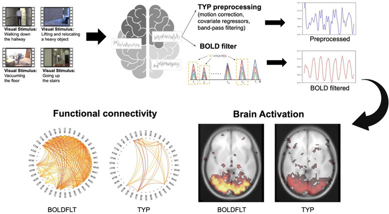 뇌 기능연결성 분석 민감도 11배 높...